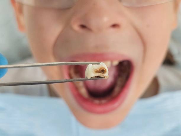 Best Emergency Pediatric Dental Care in Belleville, WI